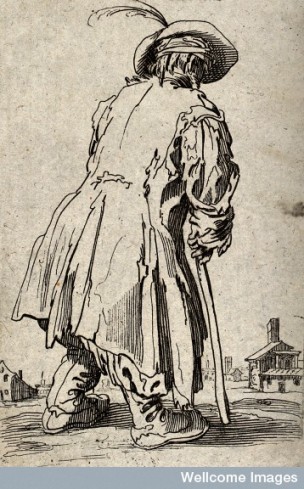 "A beggar dressed in rags, limping with the aid of a staff towards a village." Etching possibly after Jacques Callot. Wellcome Library, London. Copyrighted work available under Creative Commons Attribution only licence CC BY 4.0 